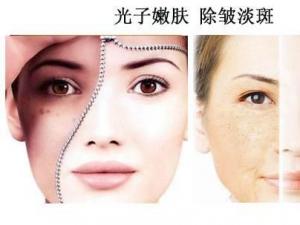 ����ȥ�~β�yҪע��ʲô���������w���ӡЧ���Æ�