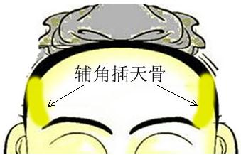 骨相圖解：輔角插天骨