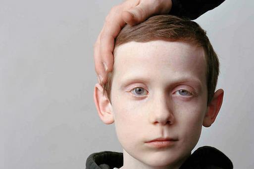 注重6個細節(jié)幫助你遠離面癱