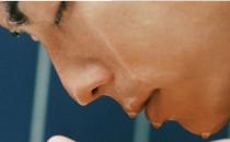 男性如何護理好冬季干燥的皮膚