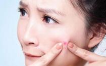 臉上各種“粉刺”的區別和應對方法