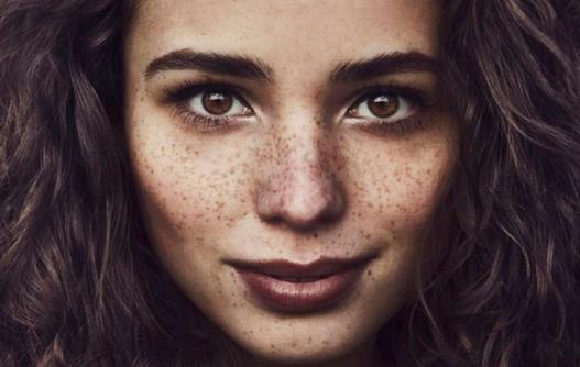 雀斑是如何形成的 找準(zhǔn)原因去雀斑