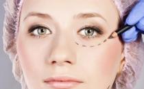 整形美容的常見誤區