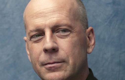 禿頭男是怎樣煉成的？