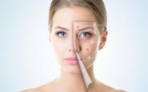 3個保養原則還你好肌膚