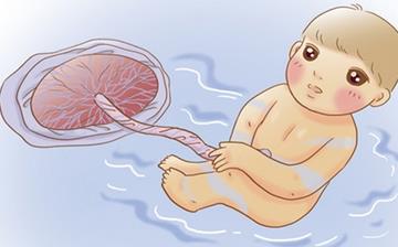 【臍帶】臍帶繞頸_臍帶繞頸能順產嗎_正常臍帶繞頸的調整方法_臍帶兩周不脫落怎么辦