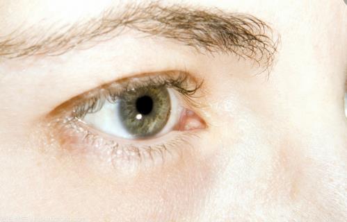 眼屎多居然暗示著這幾大疾病