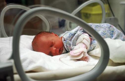 治新生兒黃疸 新生兒出現黃疸該如何護理