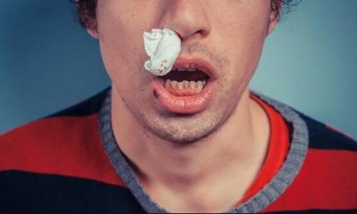 流鼻血和癌癥是否有關(guān)系 勿忽視身體發(fā)出的求救信號(hào)