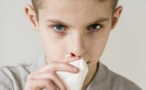 流鼻血和癌癥是否有關系 勿忽視身體發出的求救信號