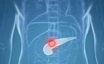 胰腺炎死亡率高達70％ 胰腺炎發病給人體發出的警報