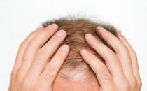 男人總是會出現脫發現象 改善男性脫發的食物推薦