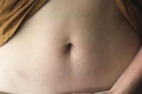 肚臍有“黑泥”，如果摳掉會怎樣？不少人弄錯了，別再亂