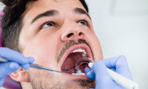 為了美白反而傷害牙齒？洗牙不是你想得那樣！