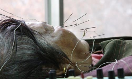 警惕!氣溫驟變,多人中招口眼歪斜、面部麻木……此季高