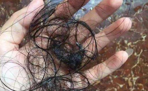 中年人的頭發會掉會變白的原因 做好預防遠離這些困擾