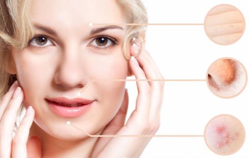 皮膚油怎么辦 5個方法幫你正確控油