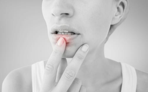 嘴唇干燥脫皮怎么辦 推薦幾個(gè)護(hù)理方法