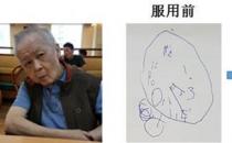 新加坡『腦復生』：改善老年癡呆的新希望