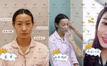 自體多肽脂肪實(shí)現(xiàn)新突破，塑造無法復(fù)制的自然美