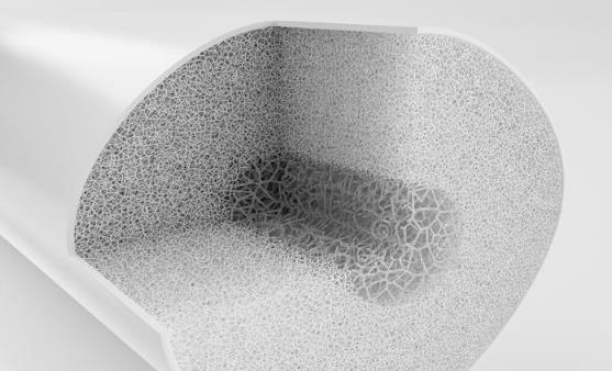 骨質疏松的認知誤區你中了沒 骨質疏松的飲食保健