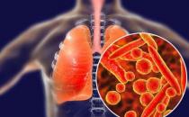 一文讀懂 | 預防新型冠狀病毒肺炎 感染源、傳染方式及癥狀表現