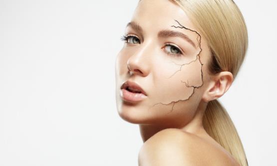 皮膚缺水的表現你中招了嗎