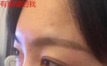 衛婭日記:我一直都以為眼袋對我的影響只是美觀,直到我了解以后……