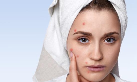 換季時期皮膚得了公主病 敏感肌怎么護理才能遠離過敏